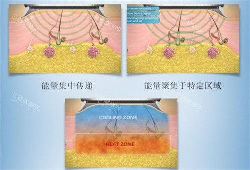 清新微波工作原理