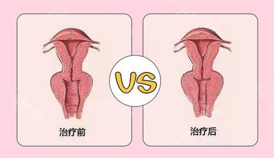 德州宝妈亲测！阴道紧缩术选这3家医院真能少踩坑？这几家医院的真实口碑藏不住了~
