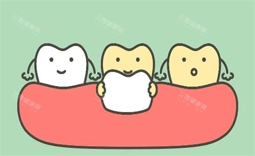 2025 年必看！百色雅洁口腔超全价格表，种牙、矫正、修复费用一目了然！