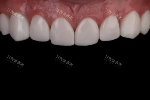 惊爆！广西蓝天口腔价格表大揭秘，种植牙低至 2980 元起，速来了解！