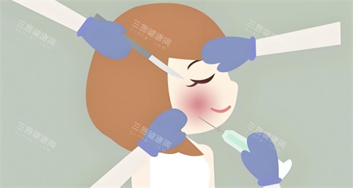 亲身经历贴骨针一年后脸垮了!分享我的修复经历与选择正规医院的重要性