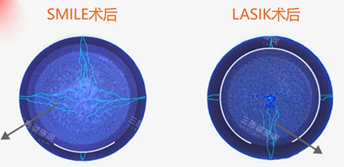 邢台眼科挂号网上预约挂号攻略：步骤清晰，轻松预约不费力