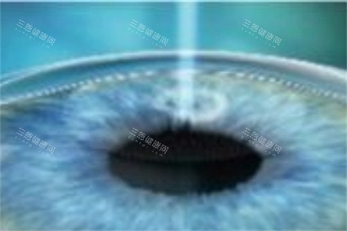 慈溪博视眼科医院怎么样？医生正规+设备靠前，眼科诊疗放心选