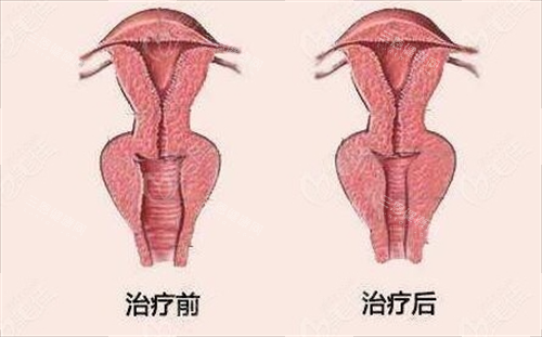 西安国内外医学中心付丹凤医生做私密类整形怎么样？经验充足结果好，选她很靠谱