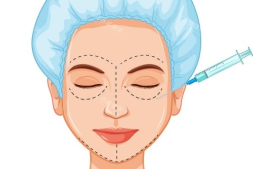 面部注射卡通图片展示