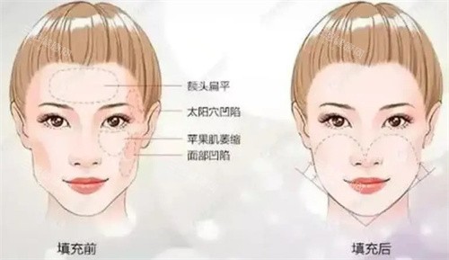 长沙轻医美口碑榜新贵：美诺美和凭“真人实例+医生耐心”稳坐推荐C位~