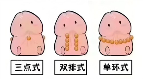 入珠手术动画2