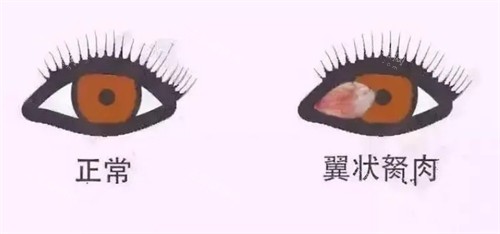 利川人民医院眼科做近视手术靠谱吗？真实体验+技术拆解告诉你答案！