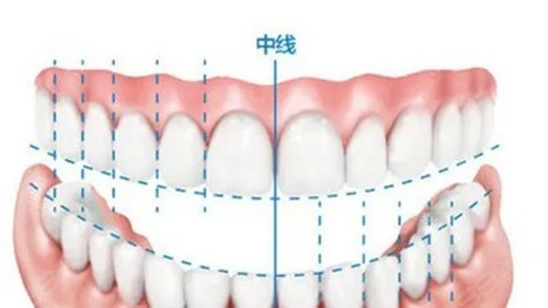 西安佛莱堡口腔技术优势_成功案例_患者评价_术后保障_超详细介绍一文全览，值得一看！