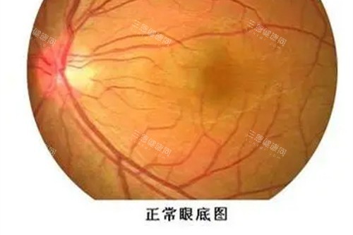 近视眼手术宣传图
