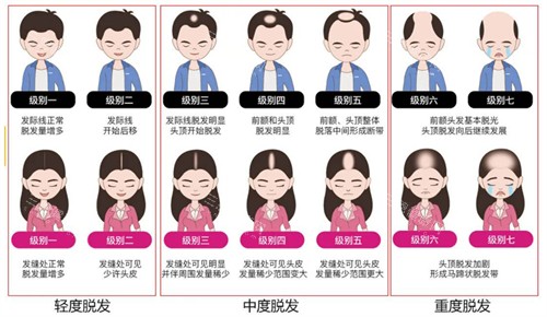 南方医学大学珠江医院整形科周伟豪医生怎么样？一文读懂背景、技术、口碑