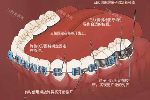 2025年成都金石口腔的真实收费情况：种植牙1880元起、牙齿矫正6800元起、补牙209元起