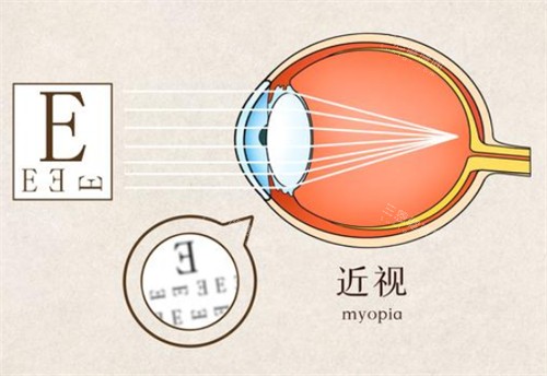 2025济南明水眼科价格表曝光！近视手术12800元，白内障/青光眼收费+地址交通全整理！