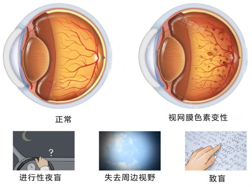 徐州第一人民医院哪个医生看眼科好？各项目靠谱医生大家直接按照名单找！