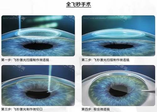 天津市眼科医院最新价格表：近视激光 9800 起、白内障 2800 起、角膜塑形镜 5200 起