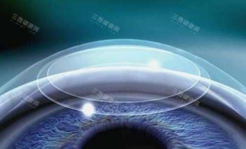 上海爱尔浦亮眼科医院手术价格大公开：白内障飞秒辅助手术 17600 起、斜视矫正 8200 起