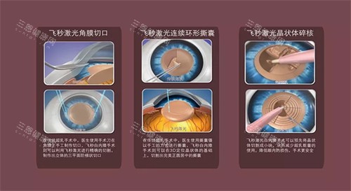 河北省 2025 白内障手术免费政策实情曝光：适用人群+申请流程，一文读懂