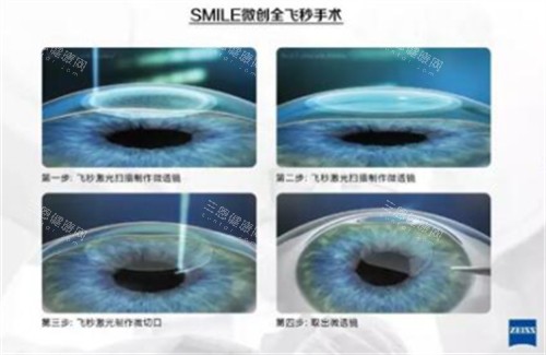 龙岩市第二医院眼科中心怎么预约挂号，有电话预约/网上预约/到院预约多种挂号方式！