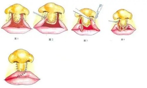 想约韩勋面诊总失败？手把手教你抢韩勋面诊号！全新挂号攻略+避坑指南收藏这篇就够~