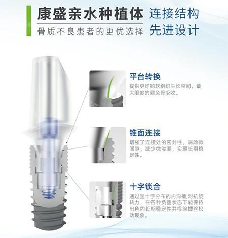 康盛种植牙多少钱一颗?价格5000元起,国产中端品牌且稳定性较好!