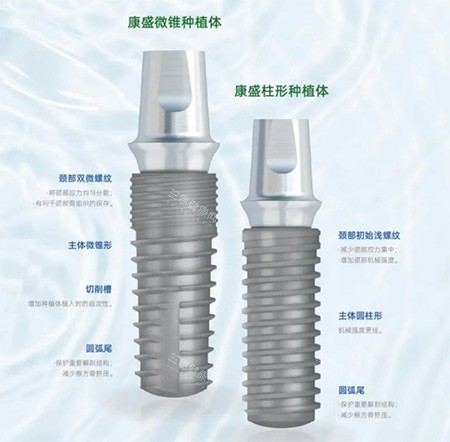 康盛种植牙体质量评测!质量好,生物相容性高,稳定耐用且型号规格多样!