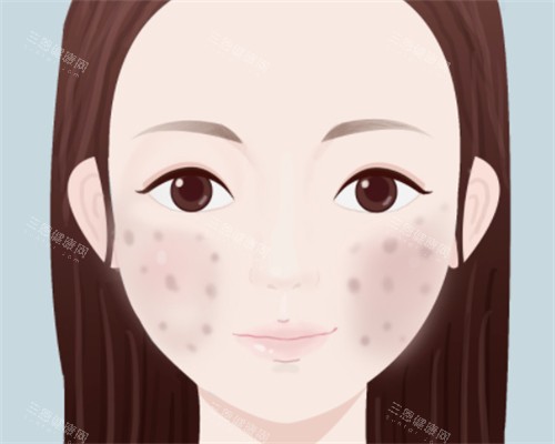 脸上痘印怎么办