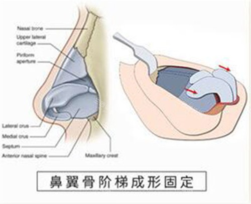 衡阳璐美仁医疗美容究竟怎么样?揭秘其正规资质与特色眼鼻整形项目,口碑评价一览