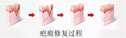 南京皮肤病研究所2025收费新标准：疤痕修复500+、祛斑480+、太田痣去除320+
