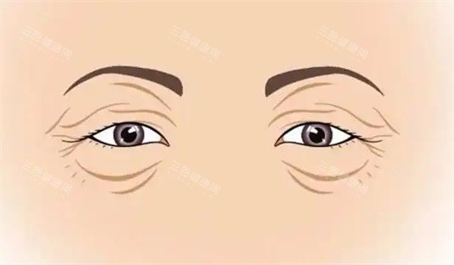衰老的双眼皮