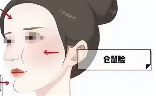 玻尿酸后馒化现象动画展示 玻尿酸后馒化现象动画展示