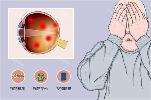 2025郑大一附院眼科优质医生坐诊表曝光：李秋明/张凤妍/李志刚等高质量医生优势解读