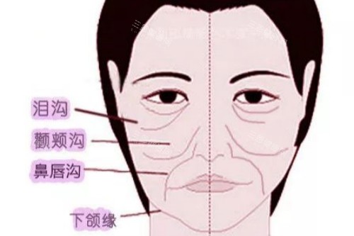 常州谢院美袋医疗美容到底怎么样?眼袋专科技术与服务全解析
