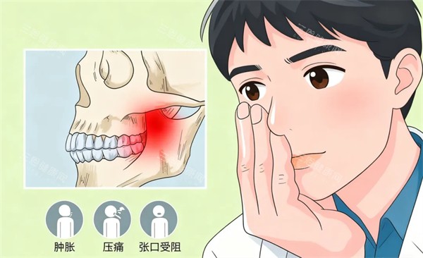 岳阳看牙齿哪个医院便宜点？金幸口腔、阳光口腔低价靠谱，种植牙 / 矫正真实收费大公开！