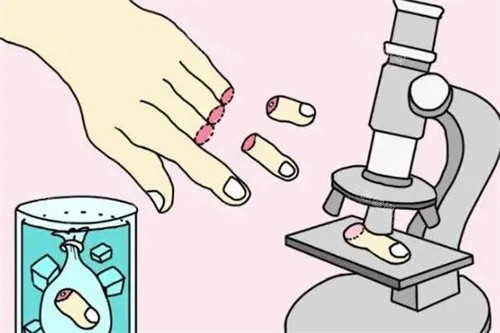 断指手术卡通图