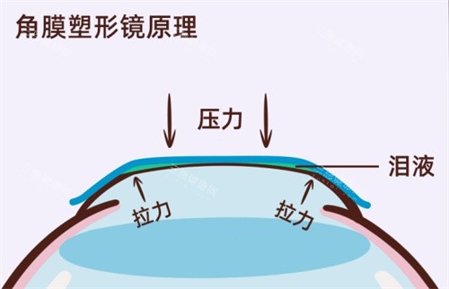 乌鲁木齐474医院眼科近视手术好约吗？地址/挂号攻略+网友体验全解析！