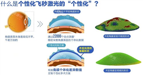 仙桃爱尔眼科医院实力揭秘！连锁品牌因素+全眼科服务，守护眼部健康超给力
