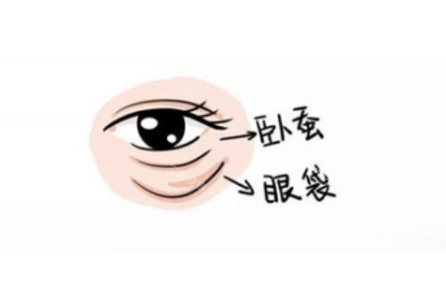 卧蚕、眼袋区别图