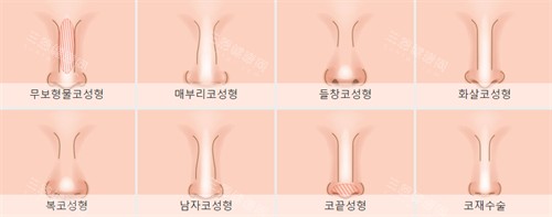 不同需要进行鼻整形的鼻子