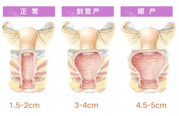 在宁波送子鸟医院做私密整形靠谱吗？真实患者分享就医体验，告诉你这家医院是否正规！