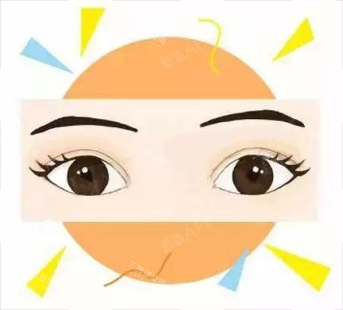 全切双眼皮**图