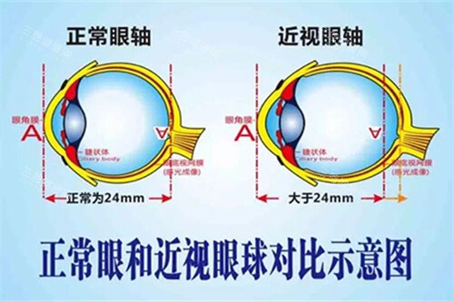 开封市中医院做近视手术好吗？引进许多新设备，医生做手术经验也比较丰富！