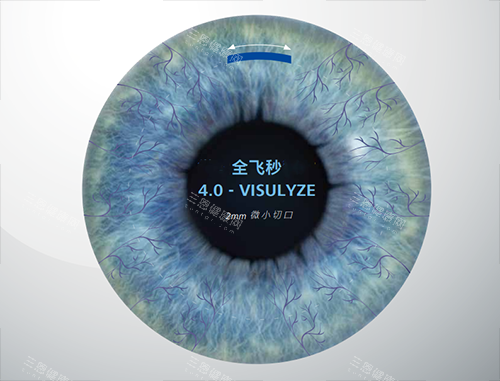 蔡司全飞秒4.0