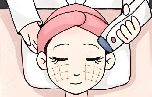 热玛吉操作过程 热玛吉操作过程