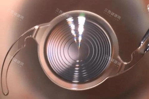 河北沧州献县众明眼科医院价格全知道！白内障手术4200元起，这份收费明细是否靠谱？
