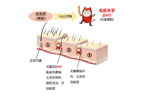 毛发缺少原因图