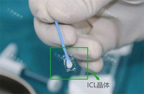 ICL晶体植入手术宣传