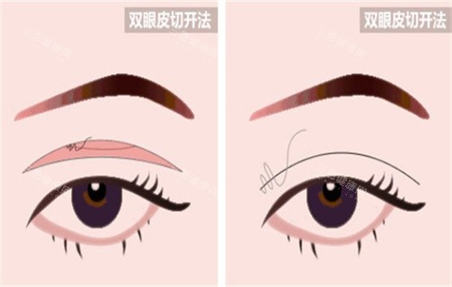 山东大学齐鲁医院24小时服务热线0531-****，医美整形解答 / 急诊挂号就医指南全在这！