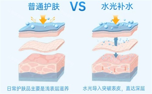 普通补水和水光补水对比 普通补水和水光补水对比