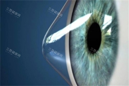 北京协和检查体验好：可加号检查，角膜病与屈光问题能妥善评估
