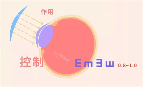 梦戴维角膜塑形镜是国产还是进口？是国产角膜塑性镜！适用人群及价格全揭晓~
